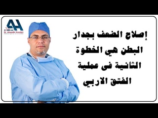إصلاح الضعف بجدار البطن هو الخطوة الثانية 