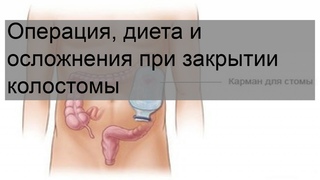 Операция, диета и осложнения при закрытии колостомы
