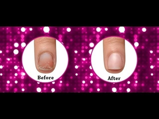 Famous Names' IBX Nail Treatment System