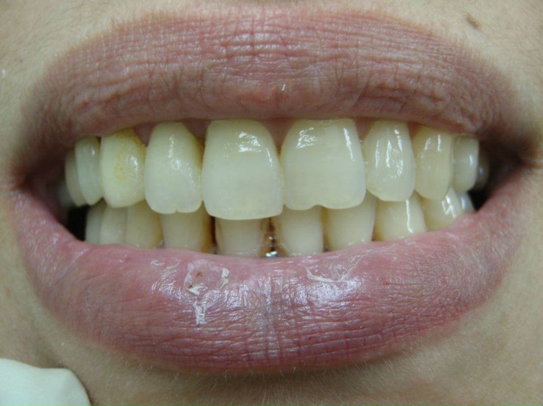 Эрнест Абрамян | Москва